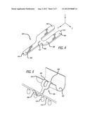 Flexible Securing Device diagram and image