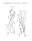 ATHLETIC SHOE SOLE FOR PERSONAL TRANSPORTATION DEVICE diagram and image