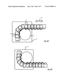 NON-BACK-BENDING CHAIN diagram and image