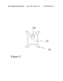 IMPLANT FOR TREATMENT OF VAGINAL AND/OR UTERINE PROLAPSE diagram and image