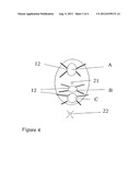 IMPLANT FOR TREATMENT OF VAGINAL AND/OR UTERINE PROLAPSE diagram and image