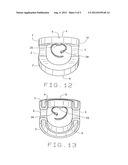 Deconstricting airway devices diagram and image