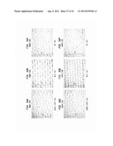 Fabric-Creped Absorbent Cellulosic Sheet Having A Variable Local Basis     Weight diagram and image