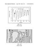 IMAGE RECONSTRUCTION INCORPORATING ORGAN MOTION diagram and image