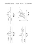 COMPUTER-AIDED DETECTION (CAD) OF INTRACRANIAL ANEURYSMS diagram and image