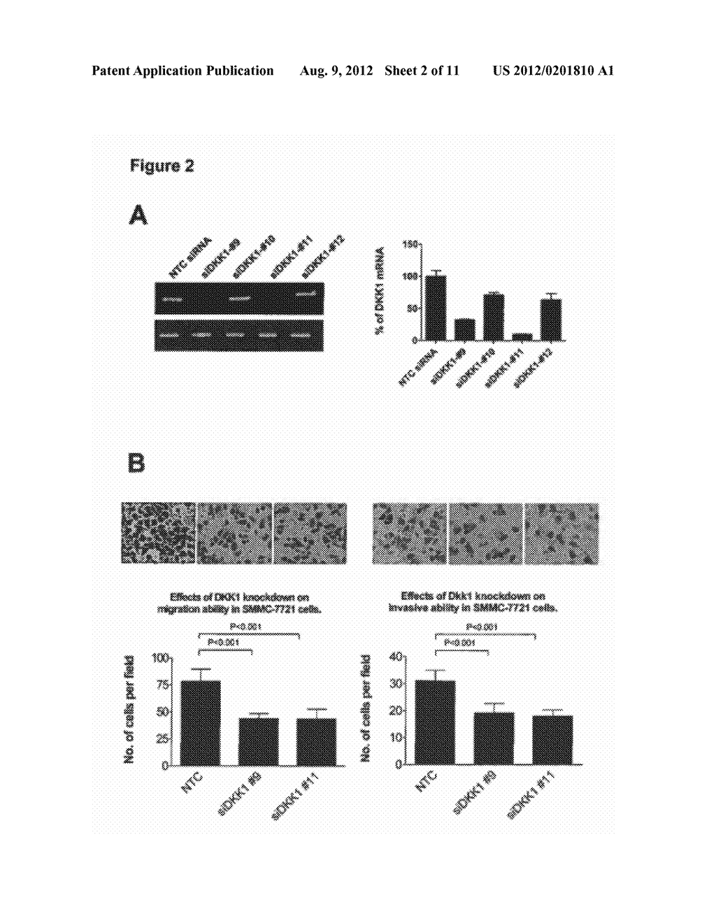 Use of Anti-DKK-1 Monoclonal Antibodies for the Treatment of Liver Cancer - diagram, schematic, and image 03