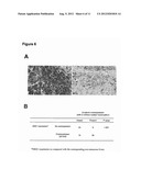 Use of Anti-DKK-1 Monoclonal Antibodies for the Treatment of Liver Cancer diagram and image