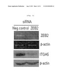 METHOD FOR SCREENING ANTICANCER AGENT OR SIP1/ZEB2 INHIBITOR USING     INTEGRIN ALPHA 5 diagram and image