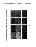 PREVENTION AND TREATMENT OF SYNUCLEINOPATHIC AND AMYLOIDOGENIC DISEASE diagram and image