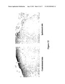 PREVENTION AND TREATMENT OF SYNUCLEINOPATHIC AND AMYLOIDOGENIC DISEASE diagram and image