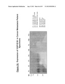 NUCLEIC ACID AND CORRESPONDING PROTEIN ENTITLED 193P1E1B USEFUL IN     TREATMENT AND DETECTION OF CANCER diagram and image