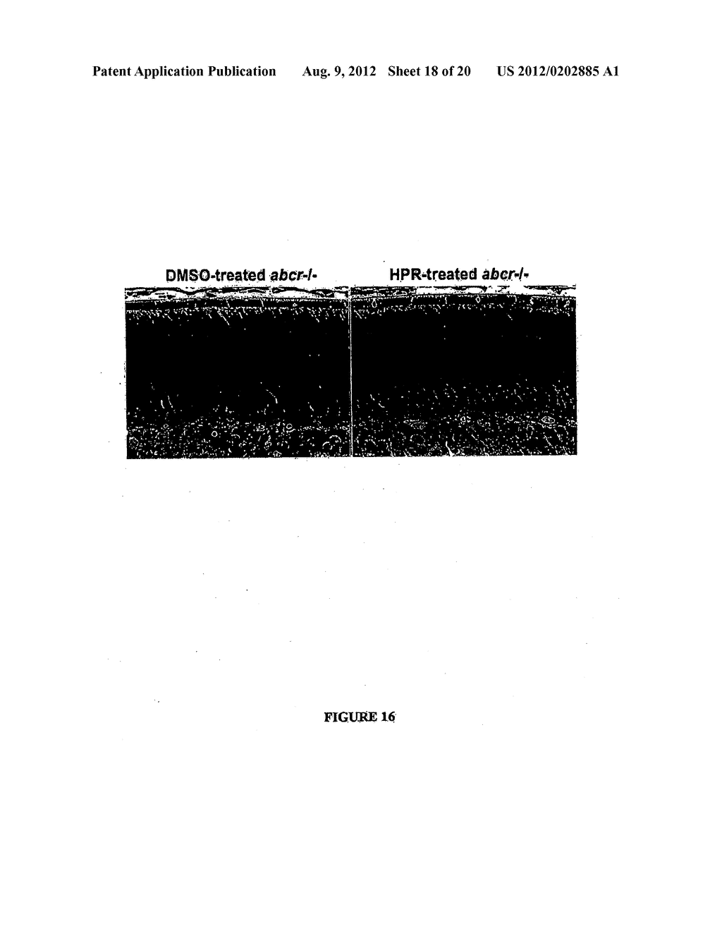 METHODS, ASSAYS  AND COMPOSITIONS FOR TREATING RETINOL-RELATED DISEASES - diagram, schematic, and image 19