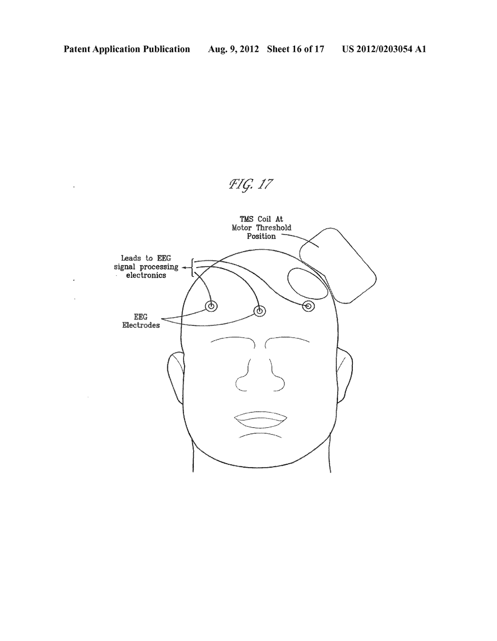 Method and Apparatus for Determining the Proximity of a TMS Coil to a     Subject's Head - diagram, schematic, and image 17