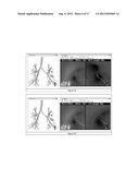 GLOBAL AND SEMI-GLOBAL REGISTRATION FOR IMAGE-BASED BRONCHOSCOPY GUIDANCE diagram and image