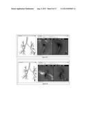 GLOBAL AND SEMI-GLOBAL REGISTRATION FOR IMAGE-BASED BRONCHOSCOPY GUIDANCE diagram and image