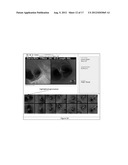 GLOBAL AND SEMI-GLOBAL REGISTRATION FOR IMAGE-BASED BRONCHOSCOPY GUIDANCE diagram and image