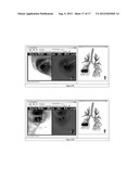 GLOBAL AND SEMI-GLOBAL REGISTRATION FOR IMAGE-BASED BRONCHOSCOPY GUIDANCE diagram and image