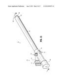 Endoluminal Access Device diagram and image