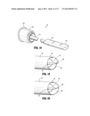 Endoluminal Access Device diagram and image