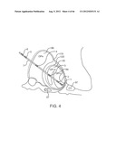 Extracranial Monitoring of Brain Activity diagram and image