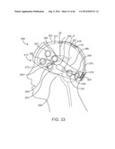 Extracranial Monitoring of Brain Activity diagram and image