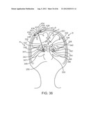 Extracranial Monitoring of Brain Activity diagram and image