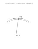 Extracranial Monitoring of Brain Activity diagram and image