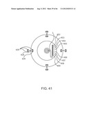 Extracranial Monitoring of Brain Activity diagram and image