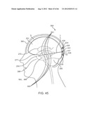 Extracranial Monitoring of Brain Activity diagram and image