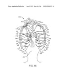 Extracranial Monitoring of Brain Activity diagram and image