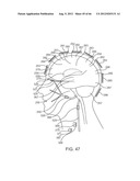 Extracranial Monitoring of Brain Activity diagram and image