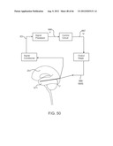 Extracranial Monitoring of Brain Activity diagram and image