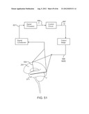 Extracranial Monitoring of Brain Activity diagram and image