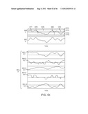 Extracranial Monitoring of Brain Activity diagram and image