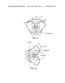 Patient Positioning Systems and Methods diagram and image