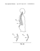 Patient Positioning Systems and Methods diagram and image