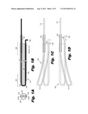 Continuous Single Wire Steerable Catheter diagram and image