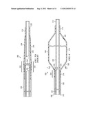 COAXIAL CATHETER SHAFT HAVING BALLOON ATTACHMENT FEATURE WITH AXIAL FLUID     PATH diagram and image