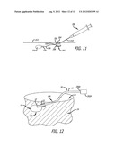 Method and apparatus for providing access to an internal body organ diagram and image