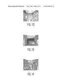 FLEXIBLE MICRODRILLING INSTRUMENTATION, KITS AND METHODS diagram and image