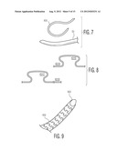 FLEXIBLE MICRODRILLING INSTRUMENTATION, KITS AND METHODS diagram and image