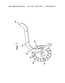 FEMORAL PROSTHETIC IMPLANT diagram and image