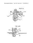 FEMORAL PROSTHETIC IMPLANT diagram and image