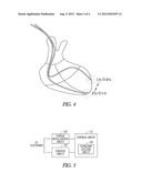 PACING SITE OPTIMIZATION USING PACED INTERVENTRICULAR DELAYS diagram and image