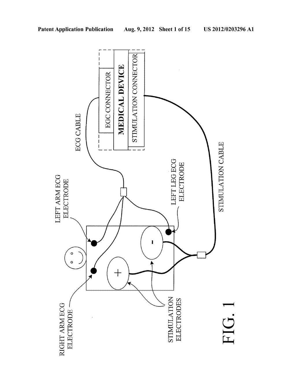 Monitoring Physiological Signals During External Electrical Stimulation - diagram, schematic, and image 02