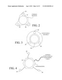 Monitoring Physiological Signals During External Electrical Stimulation diagram and image