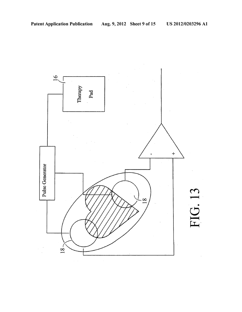 Monitoring Physiological Signals During External Electrical Stimulation - diagram, schematic, and image 10