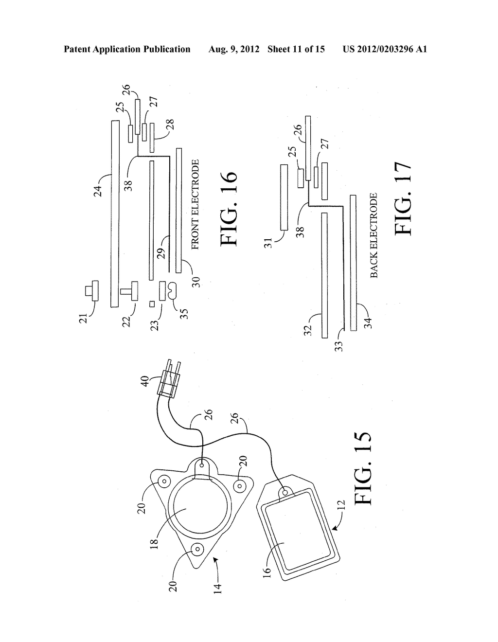 Monitoring Physiological Signals During External Electrical Stimulation - diagram, schematic, and image 12