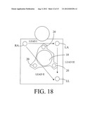 Monitoring Physiological Signals During External Electrical Stimulation diagram and image