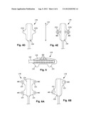 SYSTEMS AND METHODS FOR MAKING AND USING IMPROVED LEAD EXTENSION     CONNECTORS FOR ELECTRICAL STIMULATION SYSTEMS diagram and image